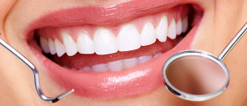 imagen-blanqueamiento-dental